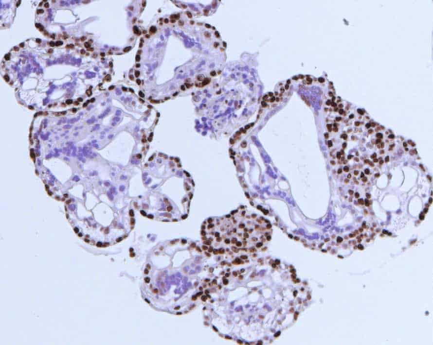 A microscope image of trophoblast cells , which replicate the early stages of the placenta in pregnancy.