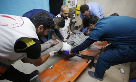 Palestinians injured in Israeli airstrikes are taken to Al-Aqsa Martyrs Hospital.