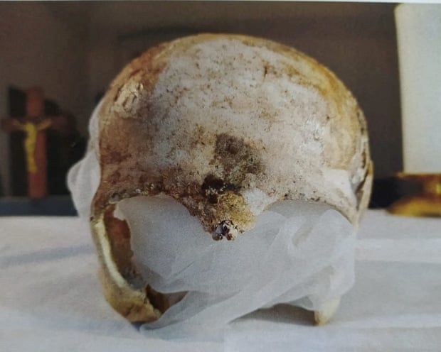 Partial skull