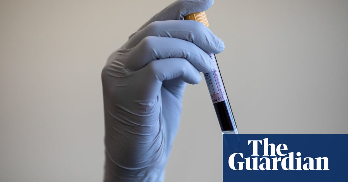 Blood test spots multiple cancers without clear symptoms, study finds