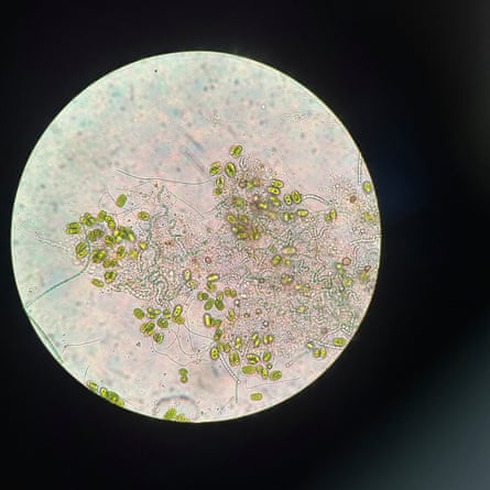 Chains of green circles and single celled green algae