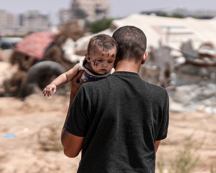 No family, no stability, no social fabric: the anguish of Gaza’s wounded orphans
