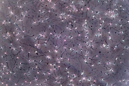 Sperm as seen through a microscope