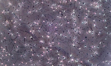 Sperm seen through a microscope