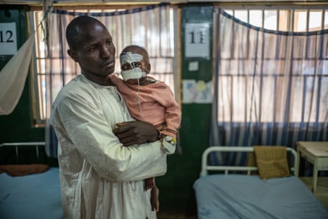 Grema and his son Mohammed arrived at the hospital after a two-day trip, but Mohammed’s face was already disfigured.