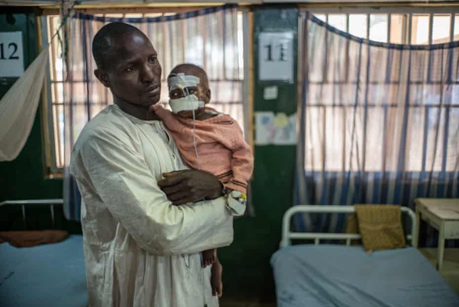 Grema and his lad Mohammed arrived astatine the infirmary aft a two-day trip, but Mohammed’s look was already disfigured.