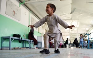 Kabul, Afghanistan  Ahmad Sayed Rahman, a five-year-old Afghan boy who lost his right leg when he was hit by a bullet in the crossfire of a battle, dances with his prosthetic leg at the International Committee of the Red Cross (ICRC) hospital for war victims and the disabled