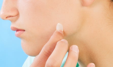 ‘They stop me from making it worse’ – Lauren Curtis on the benefits of pimple patches.