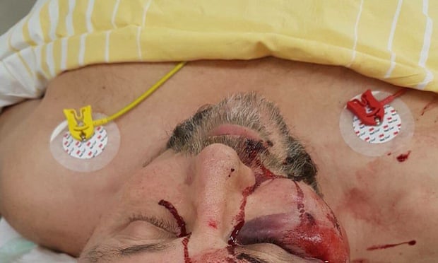 The AfD released a picture of Frank Magnitz in hospital after the attack.