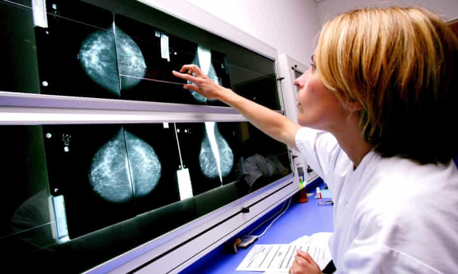 Breast cancer screening