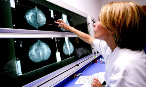 Radiologist examining mammograms