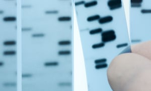 A forensic scientist specialising in DNA sequencing points to bands representing nucleotide bases (A,C,T,G) in an X-ray image.