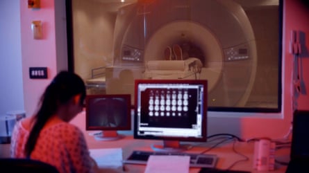 Tinnie listens to music while having an fMRI scan of his brain.