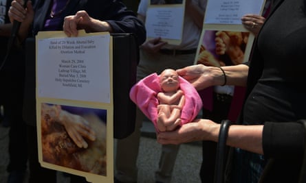 anti-abortion abortion protest fetus