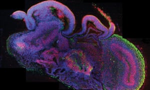 Cross-section of a cerebral organoid