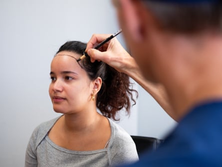 A doctor, back to camera, drawing a black line across the forehead of a young woman