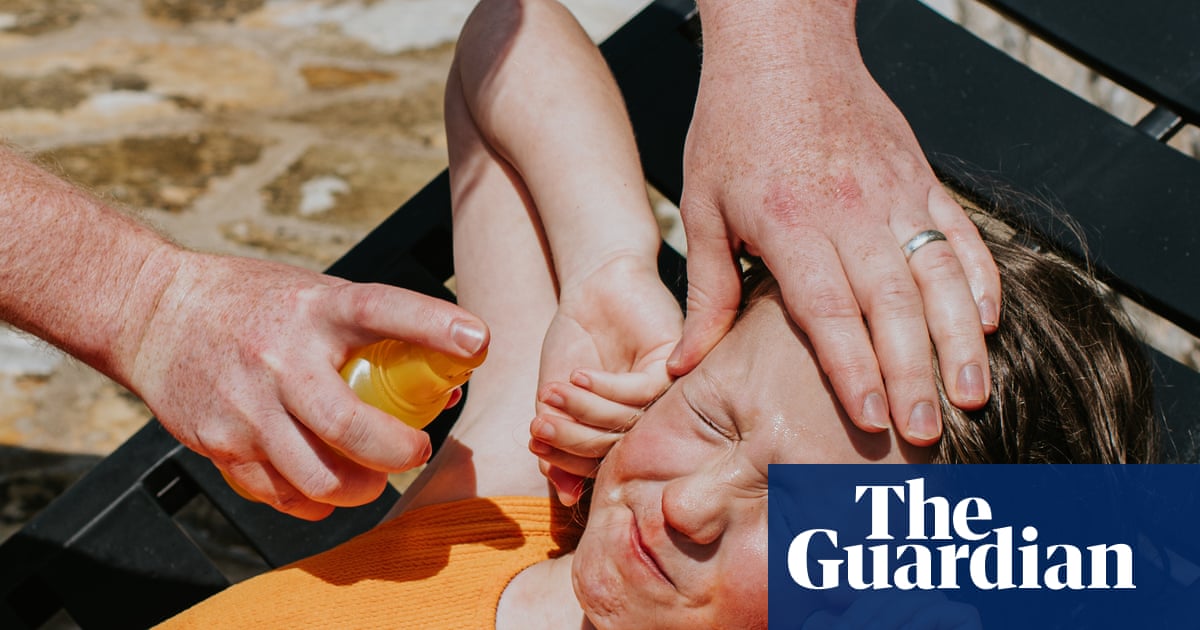 Help, my sunscreen stings! What should I do?