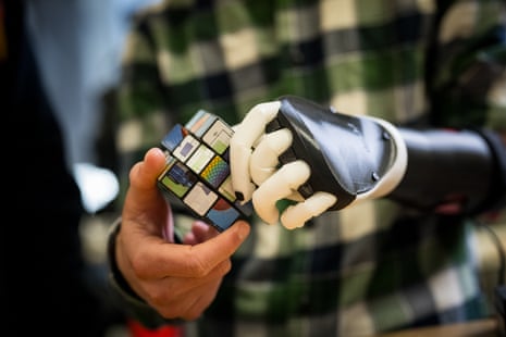 Australian scientists have created a revolutionary lightweight bionic arm.