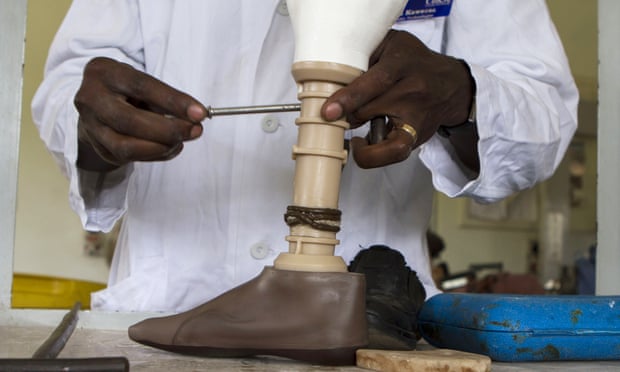 Orthopaedic technician Moses Kaweesa assembles a 3D-printed artificial leg at CoRSU hospital in Uganda.