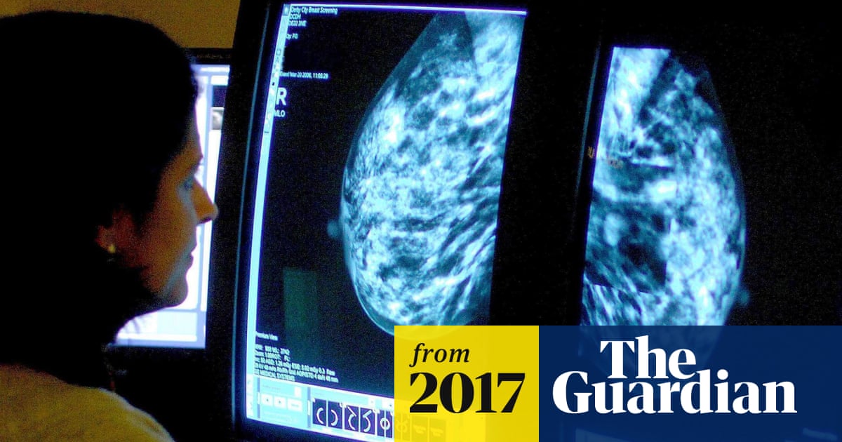 Statins could reduce risk of breast cancer death by 38%, research shows