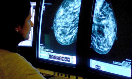 scans being examined on a monitor