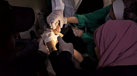 Medical workers treat a Palestinian injured in an Israeli strike, using flashlight due to the power cut at the Indonesian Hospital in the northern Gaza Strip, November 10, 2023.
