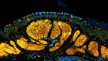 Mouse trachea showing tiny hair-like cells that move mucus and nearby nerves (blue) associated with the muscles (yellow)