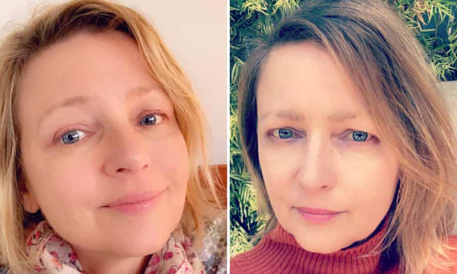 Diane McDaniel before and after