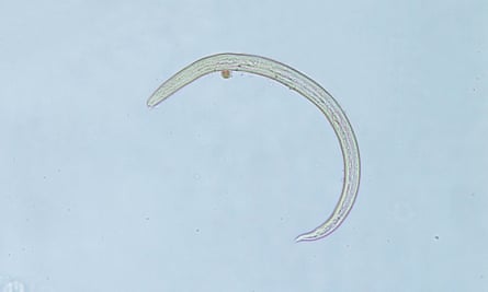 A rat lungworm