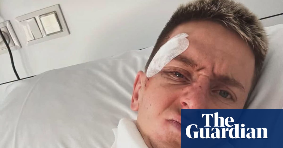 Tadej Pogacar shares picture from hospital after Vuelta-ending crash