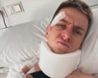 Tadej Pogacar shares picture from hospital after Vuelta-ending crash