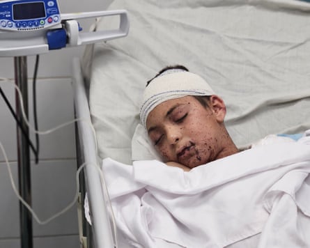 Alaa al-Najjar lies in a hospital bed with a bandage around his head