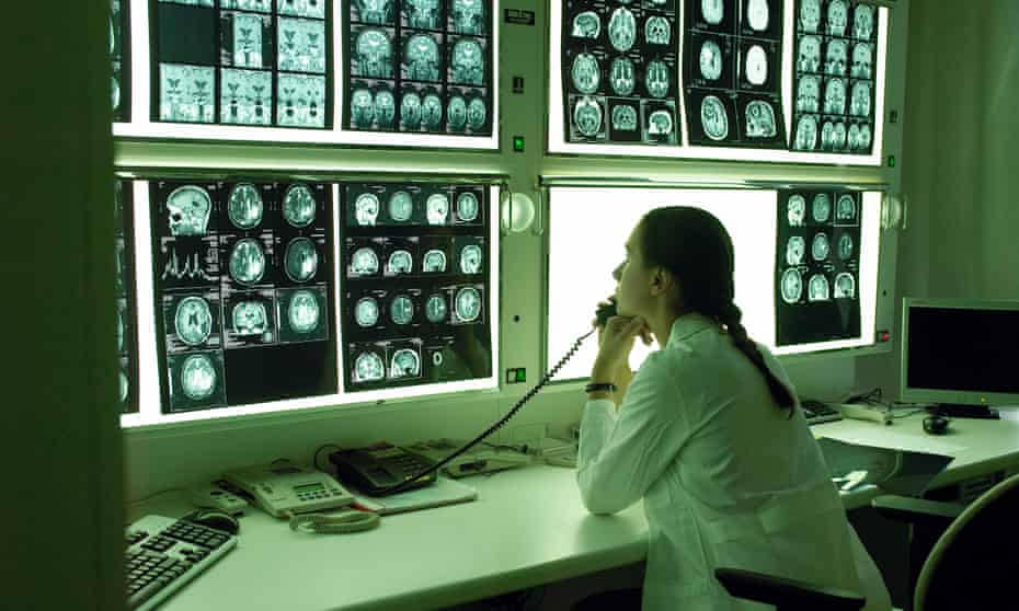 A doctor studies brain X-ray photos. 
