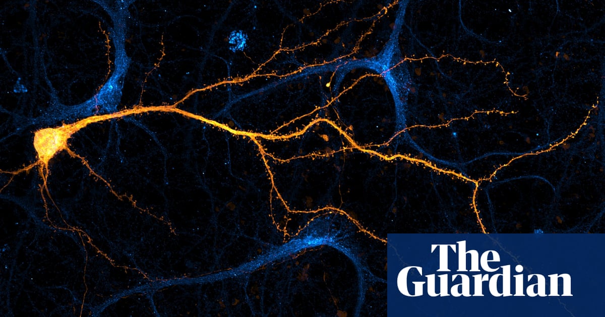 Through the lens: spectacular science on a small scale – in pictures ...