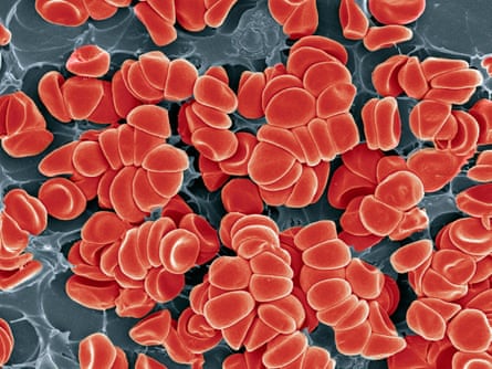 A blood clot seen under an electron microscope.