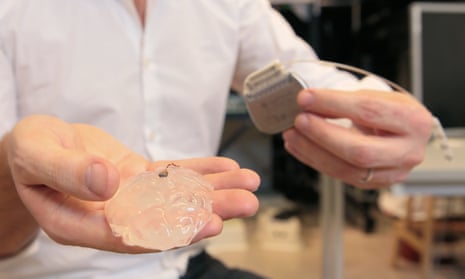 The brain-spine interface uses a brain implant like this one to detect spiking activity of the brain’s motor cortex. Seen here, a microelectrode array and a silicon model of a primate’s brain.
