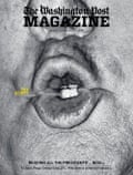A close up photo of Trump’s puckered mouth no a magazine cover.