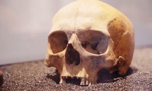 This skull of a Roman Londoner who met a violent end was found in a pit with 38 others.