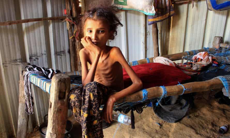 A Yemeni girl sits on her bed at a camp for the internally displaced in the northern Hajjah governorate