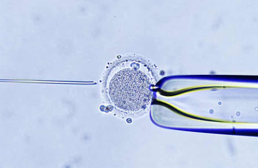 Intracytoplasmic sperm injection: ‘a kind of stylised recapitulation of sexual intercourse’.