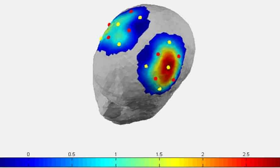 Groundbreaking System Allows Locked In Syndrome Patients To Communicate Neuroscience The Guardian Groundbreaking System Allows Locked In Syndrome Patients To Communicate Neuroscience The Guardian