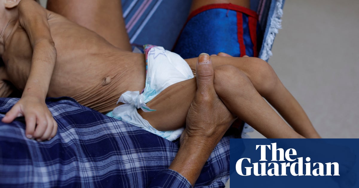 Brazil: dozens of indigenous children hospitalised amid health crisis