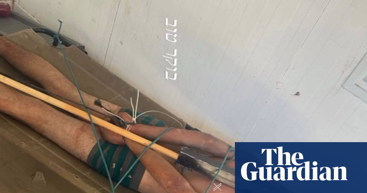 Photo of bound Palestinian detainee corroborates Israeli torture reports, say rights groups