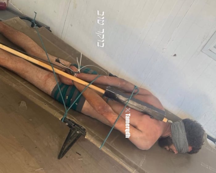 Photo of bound Palestinian detainee corroborates Israeli torture reports, say rights groups