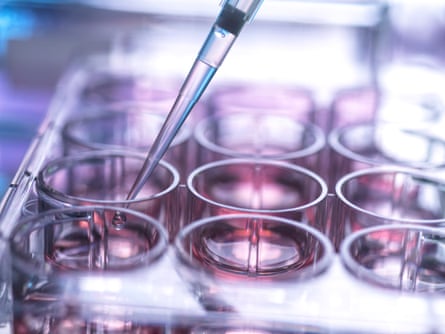 Cell sample being pipetted into multi well plate