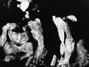 Katherine Hubbard The Great Room 05In addition Hubbard creates experimental body contact prints in the darkroom with her mother that trace the textures of skin and the physicality of aging. These tactile works materialise ability and the weight of time, celebrating the complexity of their relationship while questioning the roles of artist, subject, and collaborator. In The Great Room, Hubbard reimagines the home as a space where photography transforms care and the slow grief of dementia into a powerful act of presence and love.