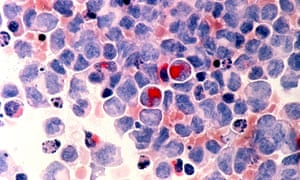 Human cells with cancer. Because the drug specifically targeted cancer cells, it didn’t show side effects associated with chemotherapy.