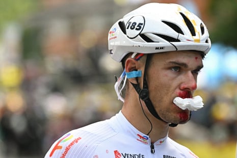 Emilien Jeanniere has had to abandon the Tour as a result of injuries he suffered in a crash on stage three.