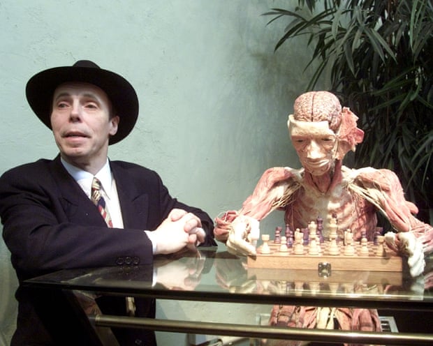 Gunther von Hagens