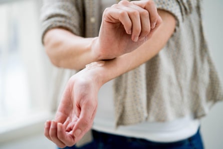 A woman applies a hrt gel to her wrist